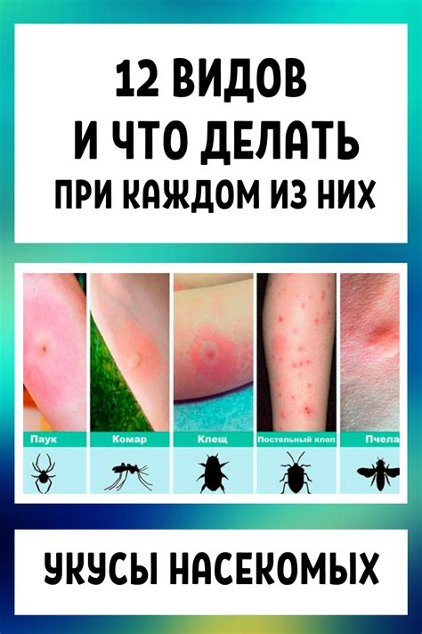 Психологическое значение снов о насекомых, обитающих на коже головы