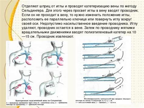 Пункция положительная в медицине