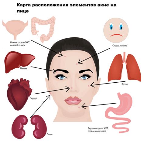 Пыль и грязь как причина прыщей