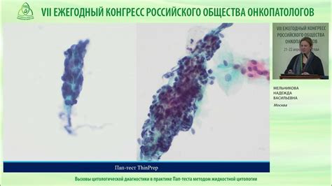 Разбираем суть ПАП-теста