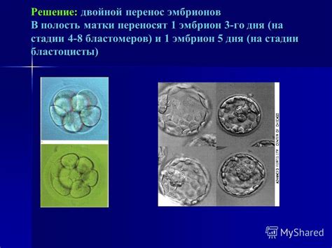 Различия в структуре и форме эмбрионов хорошего и плохого качества