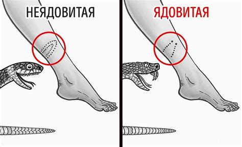 Различные интерпретации снов, где присутствует укус змеи