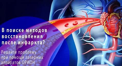 Различные методы лечения повреждения миокарда