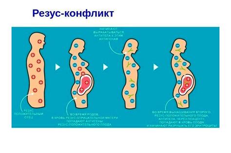 Различные типы резус-конфликта