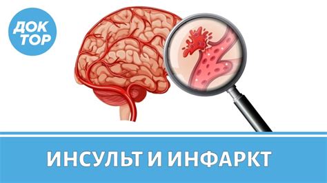 Разница между прединфарктным состоянием и инфарктом