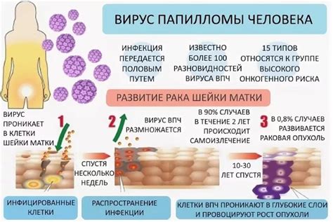 Разновидности вируса ВПЧ