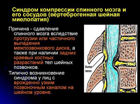 Распределение элементов конского хвоста