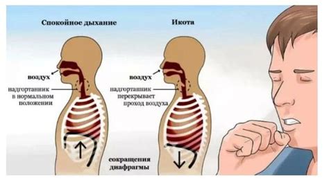 Распространённые причины икоты