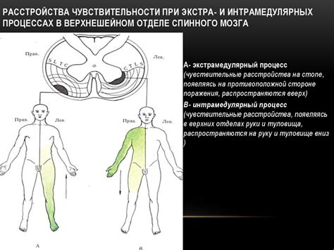 Расстройства чувствительности и покалывание