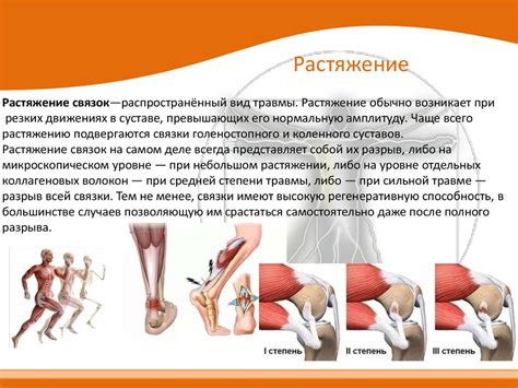 Растяжение мышц и связок в области крестца: что делать?