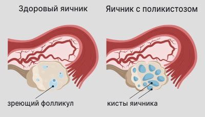 Расширенная эндометрия: основные причины и симптомы