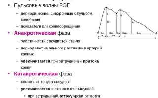 Расшифровка результатов РЭГ