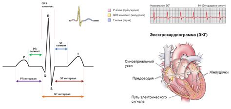 Расшифровка результатов ЭКГ при НБСНПГ