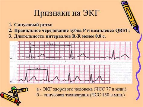 Редкий сердечный ритм: