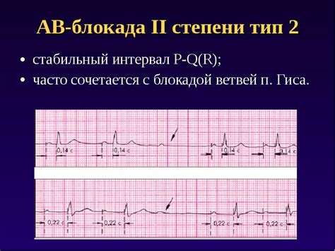 Результаты блокады при лечении