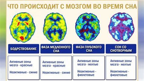 Результаты исследований активности мозга во время сна