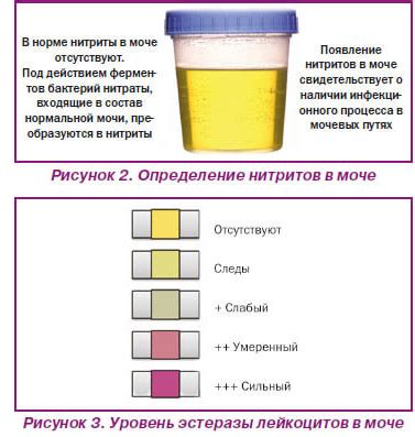 Рекомендации по улучшению цвета мочи