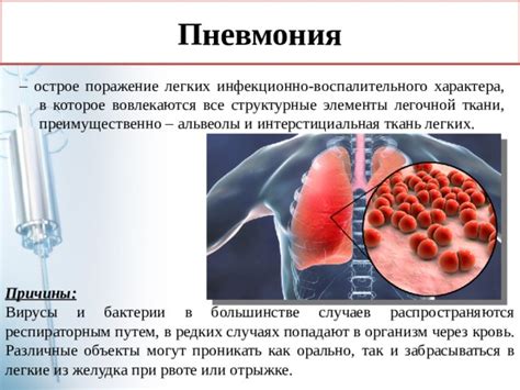 Респираторным путем: основное понятие и его значение для организма