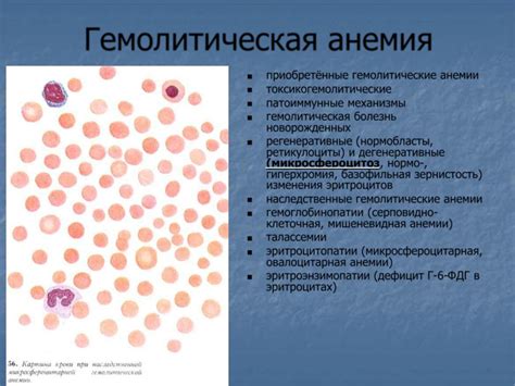 Ретикулоциты и анемия