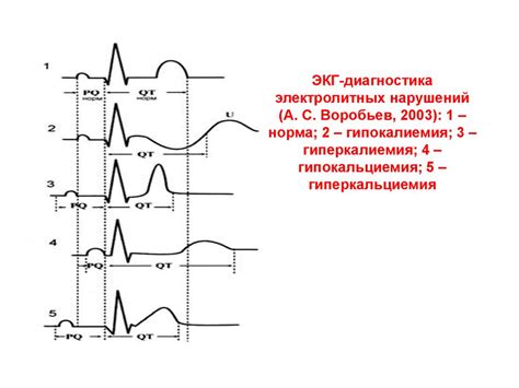 Риски и последствия умеренных диффузных изменений ЭКГ