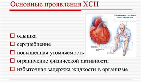 Риск 4 при хронической сердечной недостаточности: