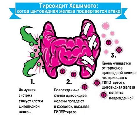 Роль Тиреоидита Хашимото в развитии нарушений в менструальном цикле