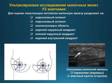 Роль ЦДК при УЗИ молочных желез