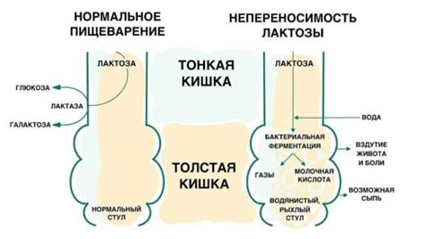 Роль генетических изменений в непереносимости лактозы