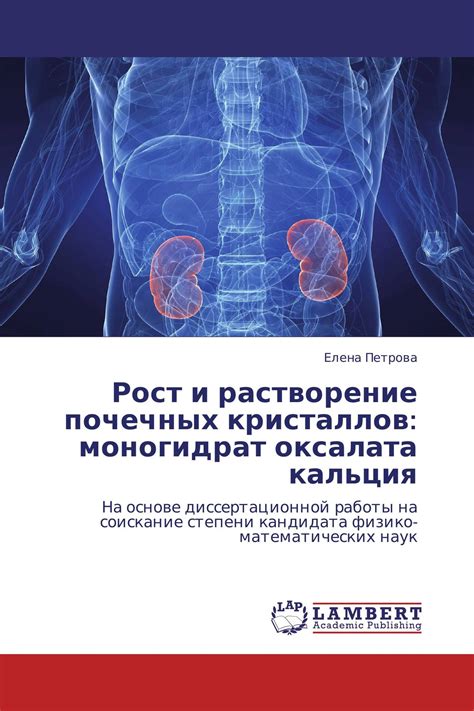 Роль оксалата кальция в образовании почечных камней