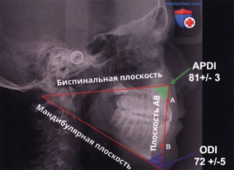 Роль скелетного класса 1 в оценке здоровья