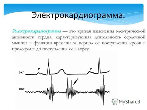 Роль электрической активности в сокращении сердечной мышцы