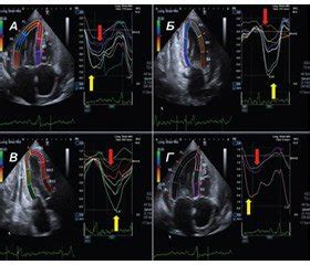 Роль эхокардиографии в диагностике сердечных заболеваний