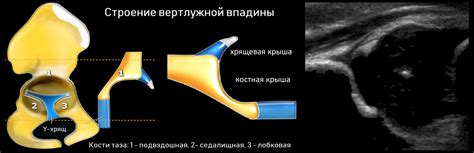 Роль 1а в диагностике тазобедренных суставов