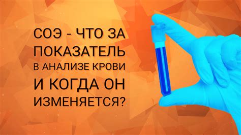 СОЭ: насколько это высокий показатель и что он означает?