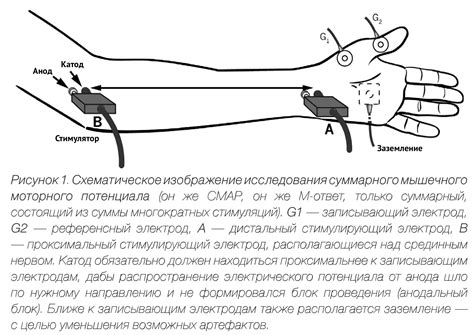 СРВ ЭНМГ и выявление мышечной слабости