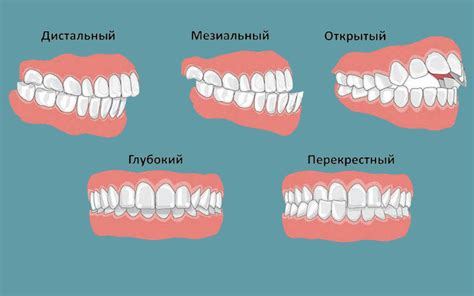 Связь прикуса щеки с фазами роста зубов