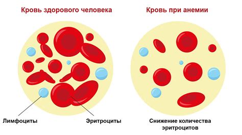 Связь размера эритроцитов с анемией