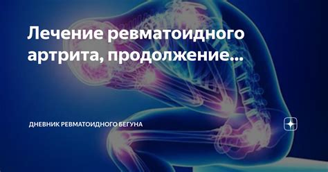 Связь ревматоидного фактора 4 с ревматоидным артритом