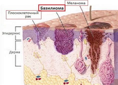 Себостатическая кожа: что это?