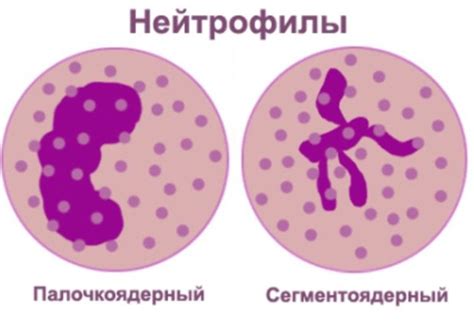 Сегментоядерные нейтрофилы понижены