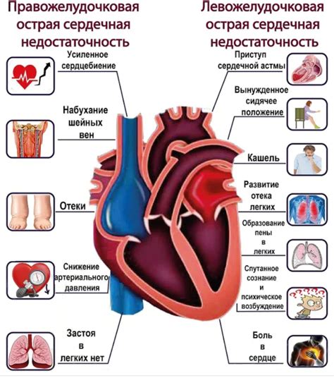 Сердечная недостаточность и ее последствия