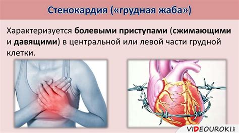 Сердечно-сосудистые заболевания и их влияние на немотивированность левой руки