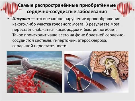 Сердечно-сосудистые заболевания и их связь с кровавыми плевками