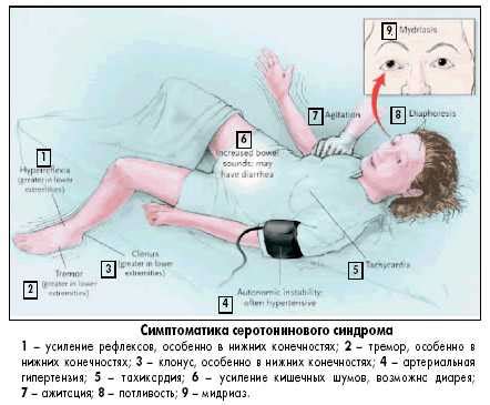 Серотонин: причины, симптомы и способы улучшения