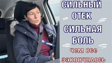 Сильная боль и отек