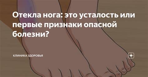 Символика ноги в сновидении: Почему именно нога поражена?
