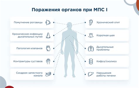 Симптомы МПС ТР 1 степени