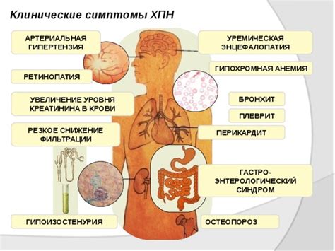 Симптомы ХПН