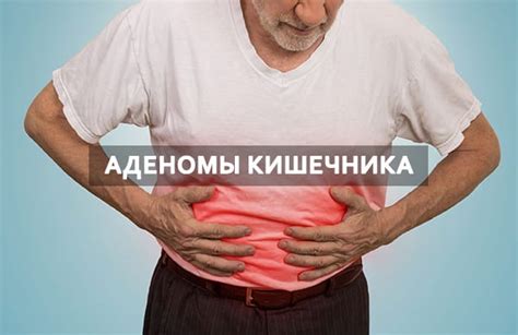 Симптомы аденомы кишечника