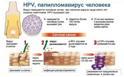 Симптомы вируса папилломы HPV 18 у женщин